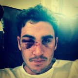 Kieswetter facing face surgery