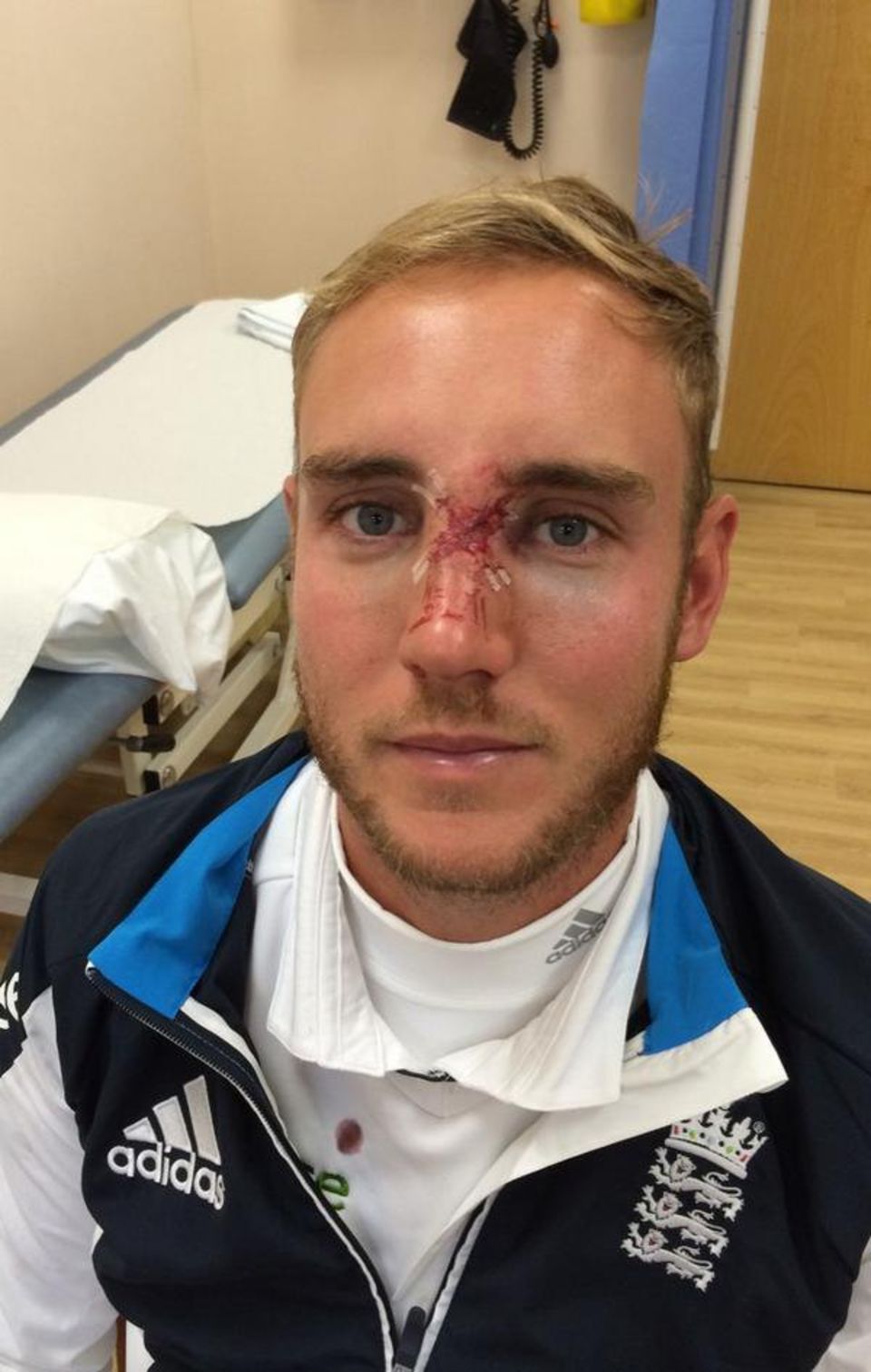 Stuart Broad has seen a specialist after suffering a fractured nose at Old Trafford