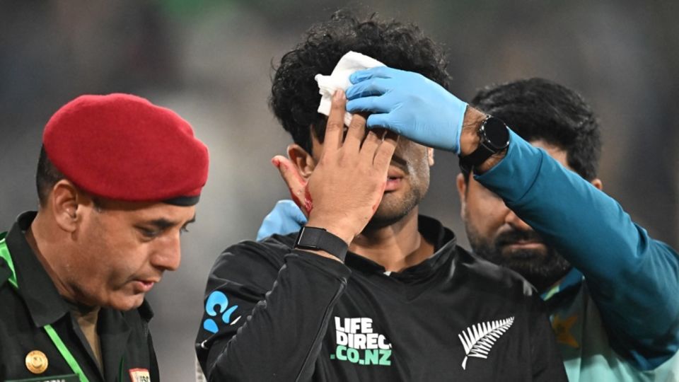 Rachin Ravindra was struck by the ball on his forehead during the tri-series