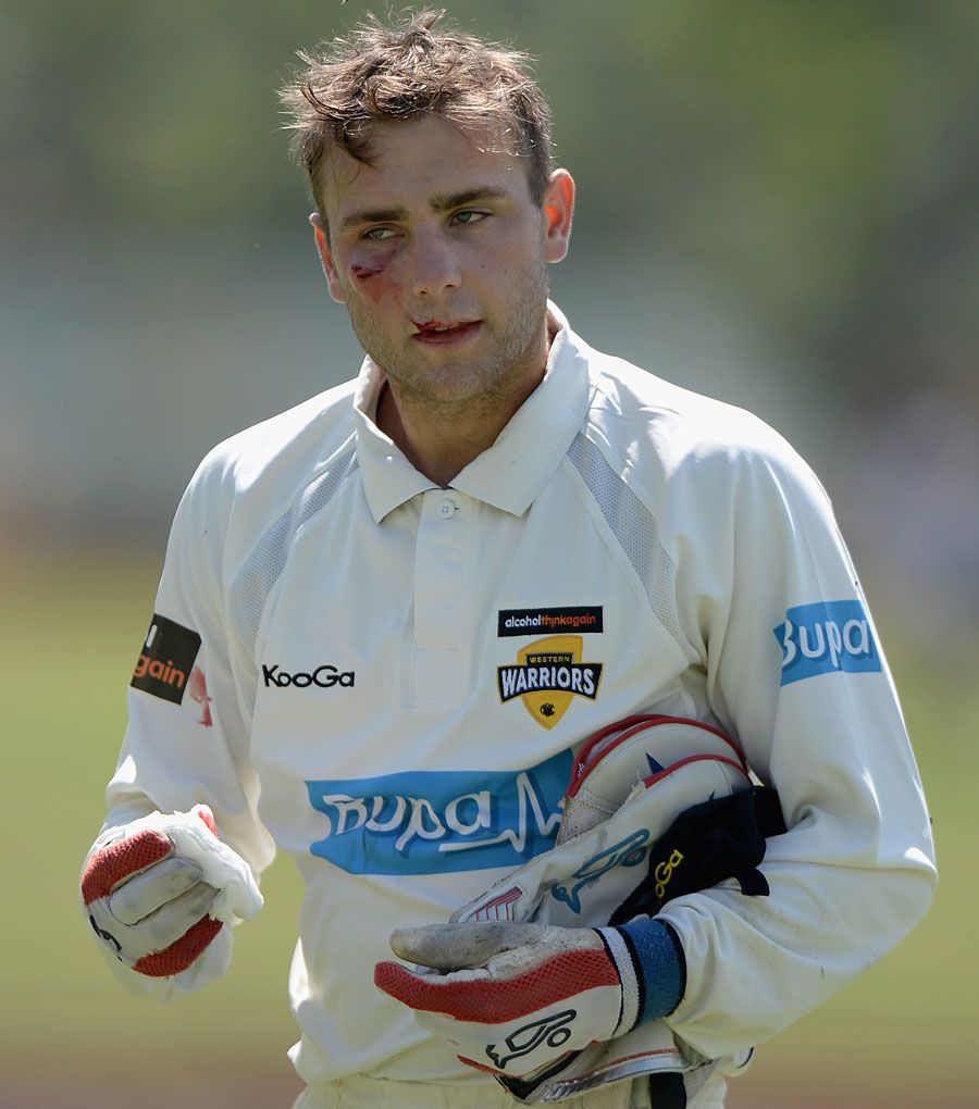 Tom Triffitt took a nasty blow in the face while keeping wicket
