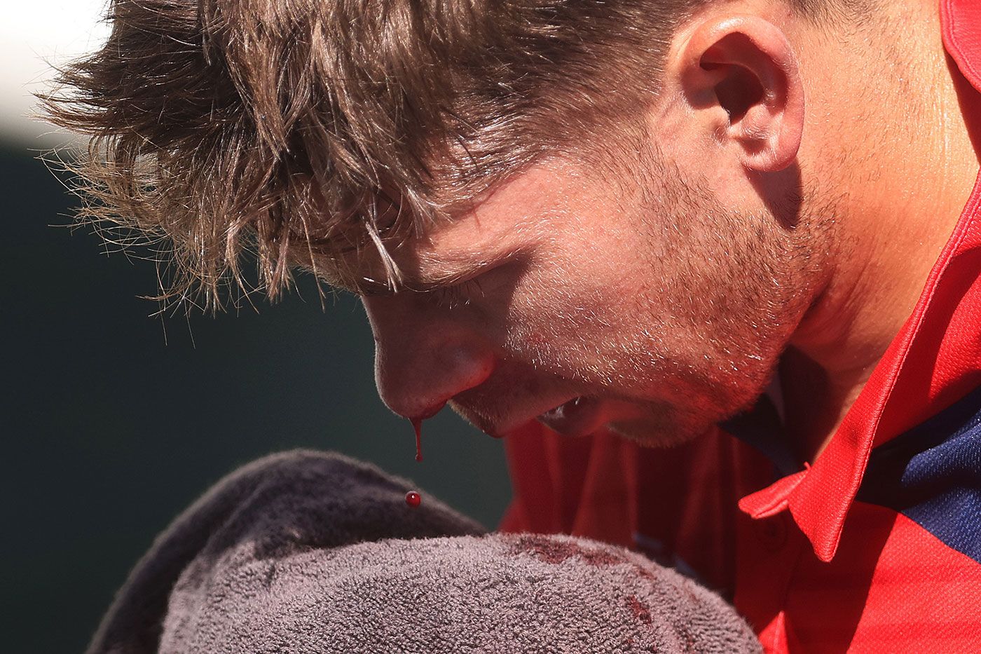 Henry Hunt suffered a nasty injury when he was struck in the face