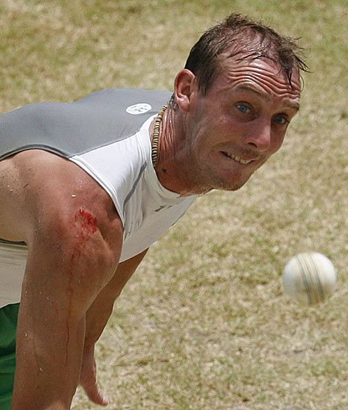 Paul Mooney, with a bloody arm, roars into bowl during a net session
