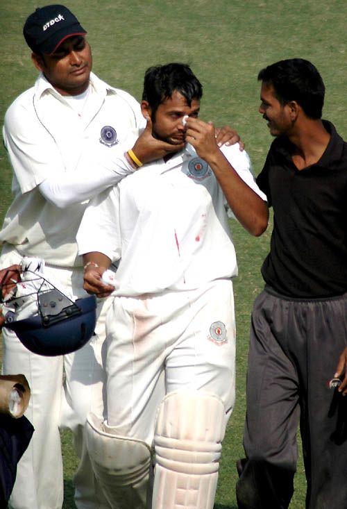 Hemal Watekar was struck on the nose by a rising delivery by Gagandeep Singh